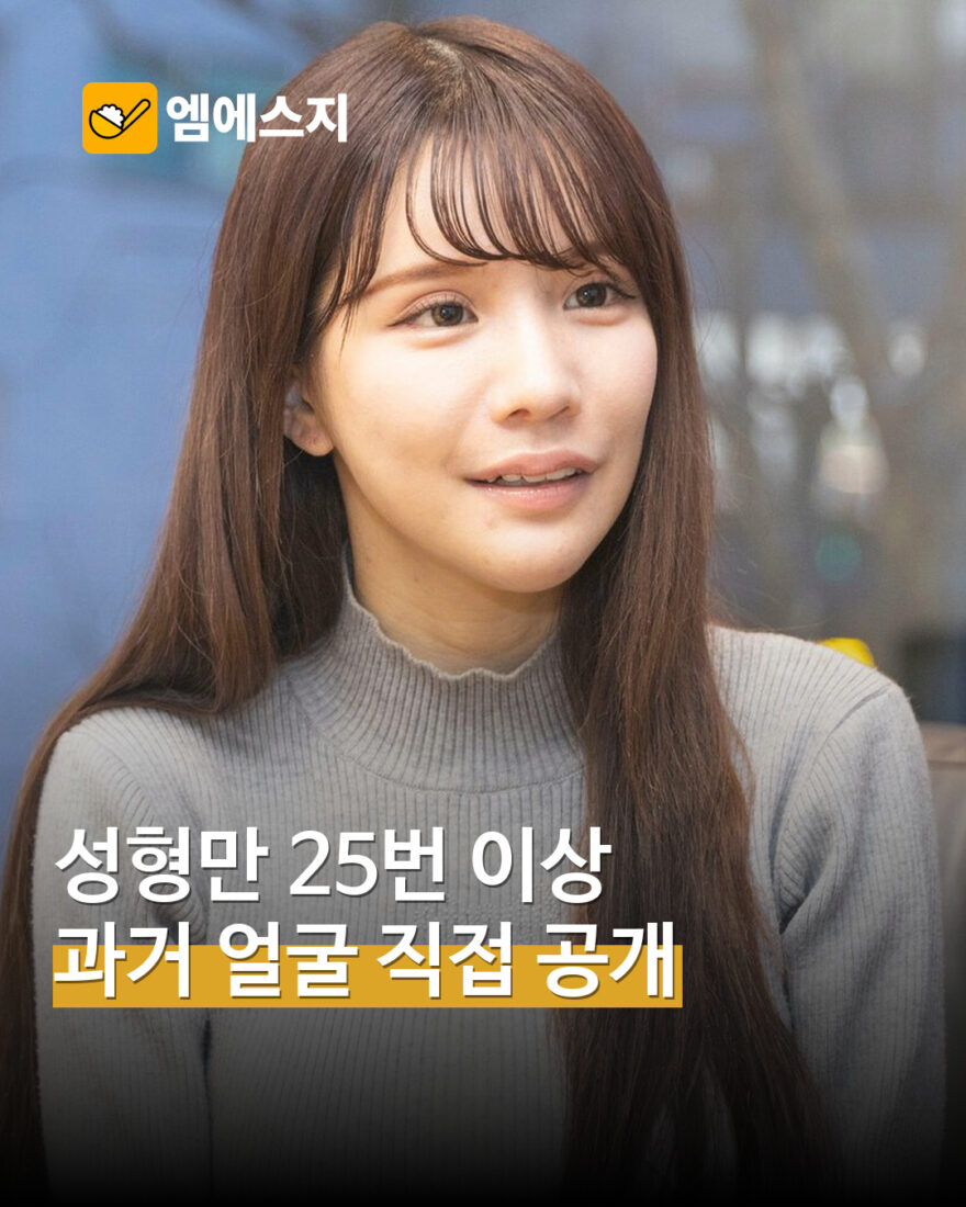 “성형만 25번 이상” 히라세 아이리, 과거 얼굴·회복 사진 직접 공개한 인터뷰 재조명 MSG뉴스 표지