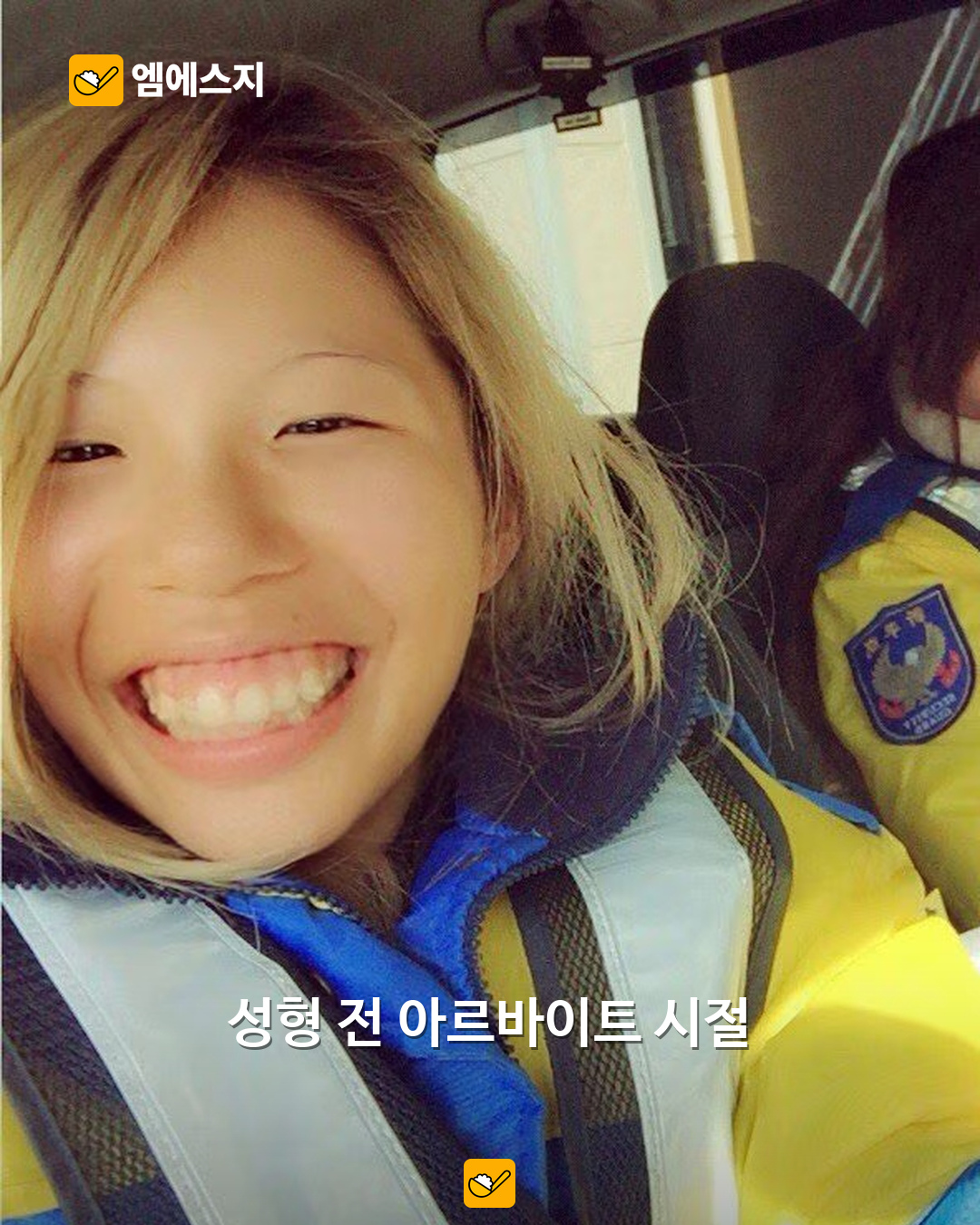 “성형만 25번 이상” 히라세 아이리, 과거 얼굴·회복 사진 직접 공개한 인터뷰 재조명 2 히라세 아이리가 2024년 인터뷰에서 공개한 성형 전 아르바이트 시절 사진
